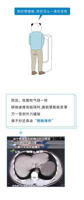 孕妇憋尿后胎儿的影响(怀孕三个月憋尿有什么影响) 第2张 孕妇憋尿后胎儿的影响(怀孕三个月憋尿有什么影响) 第2张