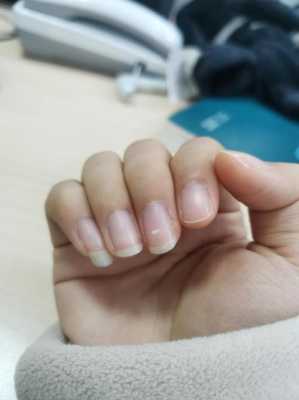 孕期身上有白点(指甲上有白斑是怎么回事) 第3张 孕期身上有白点(指甲上有白斑是怎么回事) 第3张