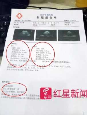 胎儿法四误诊率高吗(b超显示没有胎心会误诊吗) 第2张 胎儿法四误诊率高吗(b超显示没有胎心会误诊吗) 第2张