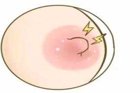 备孕期乳头痒(怀孕后乳头痒怎么办) 第2张 备孕期乳头痒(怀孕后乳头痒怎么办) 第2张