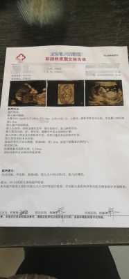 胎儿nt增厚原因有什么,正常胎儿nt也会增厚吗 第3张 胎儿nt增厚原因有什么,正常胎儿nt也会增厚吗 第3张