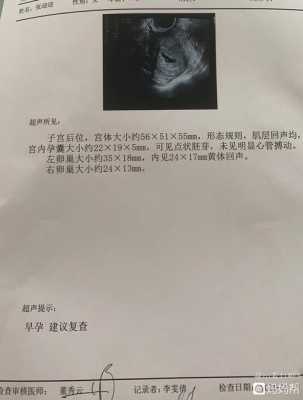 胎儿没胎心是缺叶酸(怀孕有40天了,检查看不见胎心胎芽,这是怎么回事呢) 第2张 胎儿没胎心是缺叶酸(怀孕有40天了,检查看不见胎心胎芽,这是怎么回事呢) 第2张