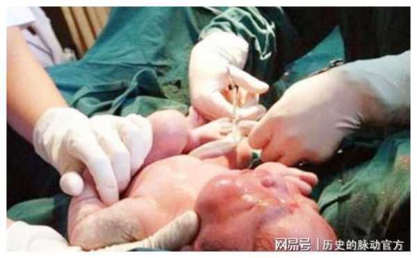 怀孕37周怎样能快点生呢?可以打催产针吗,让胎儿早点出生的办法有哪些 第1张 怀孕37周怎样能快点生呢?可以打催产针吗,让胎儿早点出生的办法有哪些 第1张