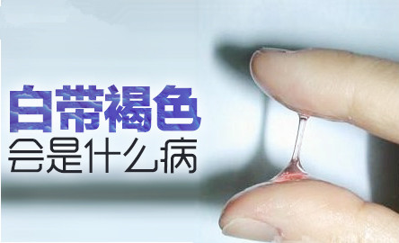 孕妇白带发黄什么原因,孕期皮肤变黄是什么原因 第2张 孕妇白带发黄什么原因,孕期皮肤变黄是什么原因 第2张