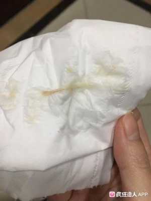 怀孕中期白带有血丝,孕期中期出血正常吗  第2张