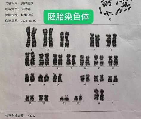 胎儿染色体检查必要吗(胎儿染色体检查什么) 第2张 胎儿染色体检查必要吗(胎儿染色体检查什么) 第2张