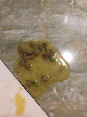 怀孕吐黄水要治疗吗,孕期呕吐黄水发苦是什么原因  第3张