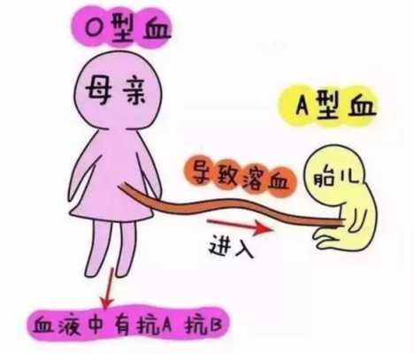 孕期没出过血(孕妇是O型血的话,需要做溶血检查吗) 第1张 孕期没出过血(孕妇是O型血的话,需要做溶血检查吗) 第1张