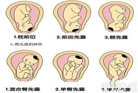 为什么胎儿喜欢臀位呢(37周宝宝在肚子里的姿势) 第2张 为什么胎儿喜欢臀位呢(37周宝宝在肚子里的姿势) 第2张