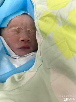 孕35周早产宝宝有事吗?宝宝成活率高吗,胎儿怀得很低有什么危害 第2张 孕35周早产宝宝有事吗?宝宝成活率高吗,胎儿怀得很低有什么危害 第2张