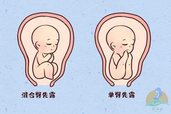 胎儿在肚子里翘屁股图(胎儿在肚子里翘屁股图片大全) 第1张 胎儿在肚子里翘屁股图(胎儿在肚子里翘屁股图片大全) 第1张