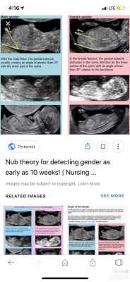 nub应该在什么位置标明,nub点和腿和脐带的分别 第1张 nub应该在什么位置标明,nub点和腿和脐带的分别 第1张