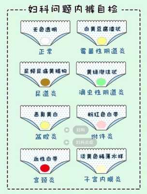 孕期白带多发黄(孕期分泌物多发黄正常吗) 第2张 孕期白带多发黄(孕期分泌物多发黄正常吗) 第2张