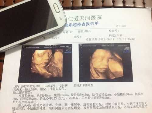 彩超能看清胎儿面部吗(怀孕16周不是可以查出面部五官了吗?做彩超怎么没有说到胎儿五官有无缺陷?到底多少周才能看清楚呢) 第2张 彩超能看清胎儿面部吗(怀孕16周不是可以查出面部五官了吗?做彩超怎么没有说到胎儿五官有无缺陷?到底多少周才能看清楚呢) 第2张