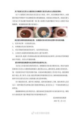 胎儿强光斑意味着什么(胎儿左心室有强光斑是什么意思啊?B超单是这样写的) 第2张 胎儿强光斑意味着什么(胎儿左心室有强光斑是什么意思啊?B超单是这样写的) 第2张
