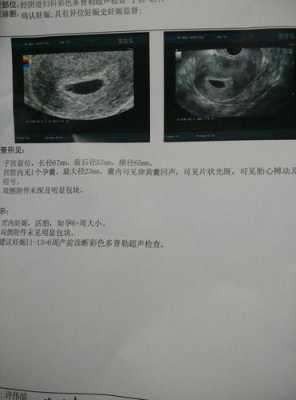 怀孕40天肚子有动静吗,胎儿40天有胎心吗? 第2张 怀孕40天肚子有动静吗,胎儿40天有胎心吗? 第2张