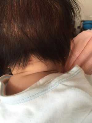 椭圆形胎儿脑袋丑死了(胎儿椭圆形头聪明) 第2张 椭圆形胎儿脑袋丑死了(胎儿椭圆形头聪明) 第2张