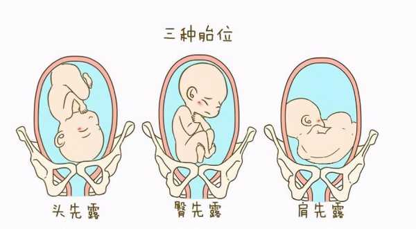 胎儿在子宫里的姿势图(胎儿在子宫里的姿势图片) 第2张 胎儿在子宫里的姿势图(胎儿在子宫里的姿势图片) 第2张