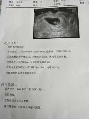 宫腔积液孕期(宫腔积液孕期三个月时候会不会好) 第1张 宫腔积液孕期(宫腔积液孕期三个月时候会不会好) 第1张