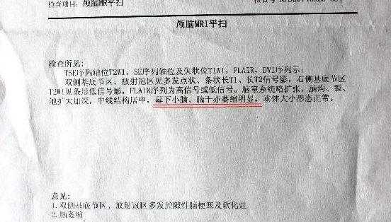 胎儿头颅磁共振报告单(胎儿头颅磁共振报告单自己能看懂吗) 第2张 胎儿头颅磁共振报告单(胎儿头颅磁共振报告单自己能看懂吗) 第2张