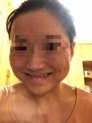 瘦脸针对胎儿有影响吗(瘦脸针对胎儿有影响吗?) 第1张 瘦脸针对胎儿有影响吗(瘦脸针对胎儿有影响吗?) 第1张
