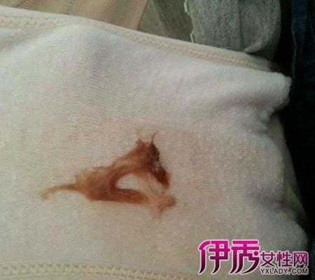 孕期见红图片(快生孩子的时候孕妇出了见红还会有什么症状) 第1张 孕期见红图片(快生孩子的时候孕妇出了见红还会有什么症状) 第1张