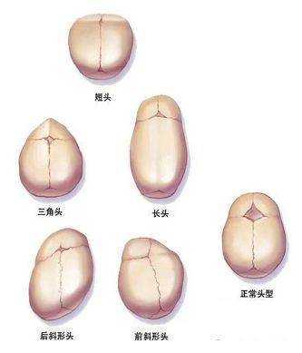 37周胎儿头部偏小怎么办,胎儿头围偏小要补什么营养 第1张 37周胎儿头部偏小怎么办,胎儿头围偏小要补什么营养 第1张