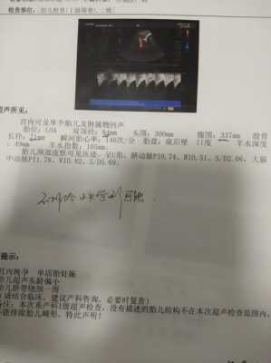 37周胎儿头部偏小怎么办,胎儿头围偏小要补什么营养 第3张 37周胎儿头部偏小怎么办,胎儿头围偏小要补什么营养 第3张