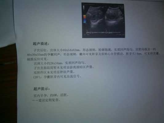 怀孕8周胎儿图片尺寸(怀孕8周胎心177正常吗) 第1张 怀孕8周胎儿图片尺寸(怀孕8周胎心177正常吗) 第1张