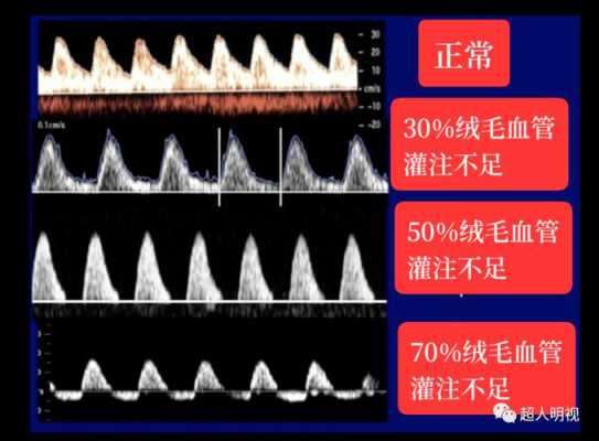 B超单显示单脐动脉是怎么回事,胎儿只有一条脐动脉正常吗 第1张 B超单显示单脐动脉是怎么回事,胎儿只有一条脐动脉正常吗 第1张