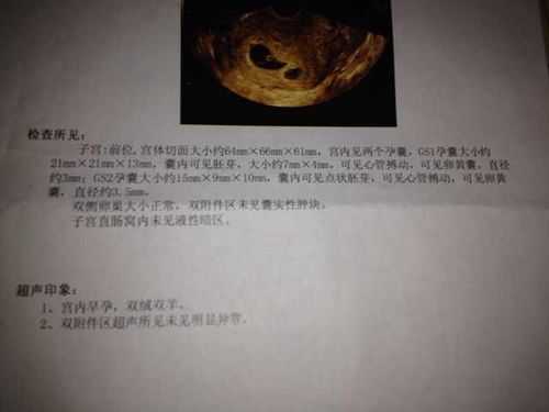 双胞胎孕期(双胎一大一小正常吗) 第1张 双胞胎孕期(双胎一大一小正常吗) 第1张