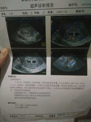 双胞胎孕期(双胎一大一小正常吗) 第3张 双胞胎孕期(双胎一大一小正常吗) 第3张