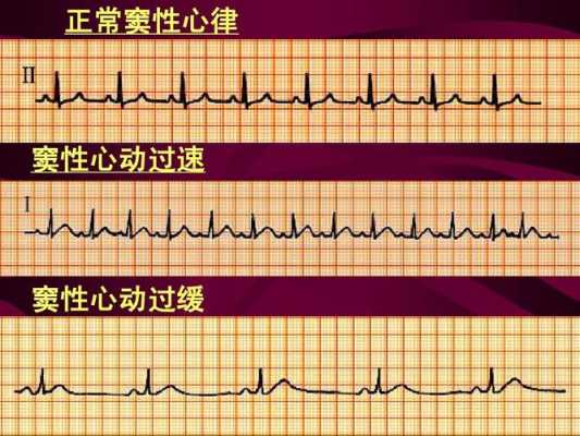 孕妇窦性心律过速110是不是属于正常的啊,孕期窦性心律过速对胎儿有影响吗 第2张 孕妇窦性心律过速110是不是属于正常的啊,孕期窦性心律过速对胎儿有影响吗 第2张
