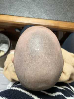 四个月宝宝舟状头还能矫正吗,胎儿颅骨呈舟状正常吗图片 第3张 四个月宝宝舟状头还能矫正吗,胎儿颅骨呈舟状正常吗图片 第3张