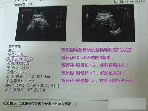 胎儿肱骨长偏短怎么办(在怀孕28周的时候胎儿股骨长偏短会影响发育吗) 第2张 胎儿肱骨长偏短怎么办(在怀孕28周的时候胎儿股骨长偏短会影响发育吗) 第2张