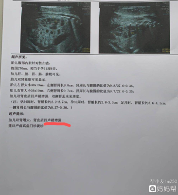 胎儿肾脏偏大问题大吗(胎儿肾脏偏大问题大吗) 第2张 胎儿肾脏偏大问题大吗(胎儿肾脏偏大问题大吗) 第2张