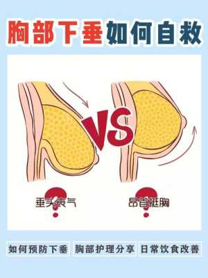 孕期怎么防止胸下垂(孕期怎么防止胸下垂呢) 第2张 孕期怎么防止胸下垂(孕期怎么防止胸下垂呢) 第2张
