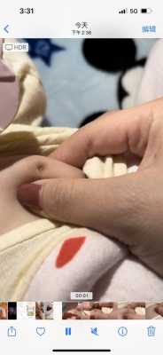 乳头上有结痂怎么办,孕期奶头上有结痂正常吗 第2张 乳头上有结痂怎么办,孕期奶头上有结痂正常吗 第2张