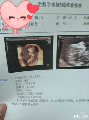 nt胎儿位置不对怎么办(nt胎儿位置不对怎么办呢) 第1张 nt胎儿位置不对怎么办(nt胎儿位置不对怎么办呢) 第1张