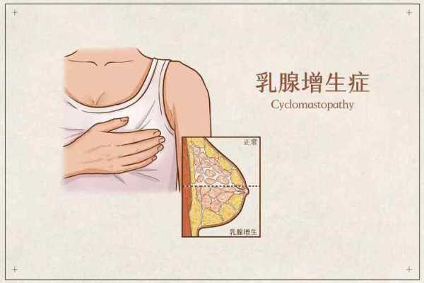 孕期乳房胀痛有硬块(哺乳期乳房里有硬块是怎么回事) 第1张 孕期乳房胀痛有硬块(哺乳期乳房里有硬块是怎么回事) 第1张