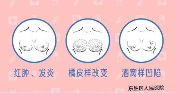 如何缓解孕期乳腺增生(哺乳期的乳腺增生,该怎么办) 第2张 如何缓解孕期乳腺增生(哺乳期的乳腺增生,该怎么办) 第2张