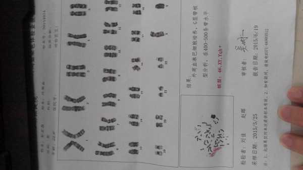 无创胎儿染色体检查(无创检查出性染色体异常怎么办) 第3张 无创胎儿染色体检查(无创检查出性染色体异常怎么办) 第3张