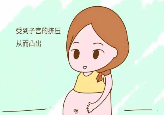 胎儿脸朝上是什么原因(孕妈肚脐凹进或凸出跟什么有关) 第3张 胎儿脸朝上是什么原因(孕妈肚脐凹进或凸出跟什么有关) 第3张