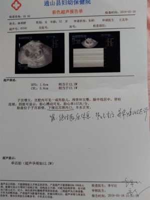 婴儿消化道畸形B超可以检查出来吗,消化道畸形胎儿的表现有哪些 第1张 婴儿消化道畸形B超可以检查出来吗,消化道畸形胎儿的表现有哪些 第1张
