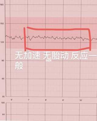 电脑胎儿监护图怎么看(电脑胎儿监护图怎么看宫缩) 第3张 电脑胎儿监护图怎么看(电脑胎儿监护图怎么看宫缩) 第3张