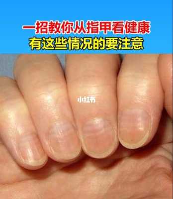 孕期指甲长得快看男女(关于指甲的科普) 第2张 孕期指甲长得快看男女(关于指甲的科普) 第2张