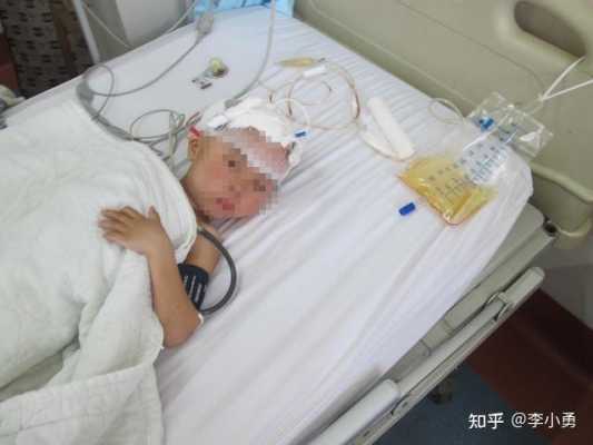 胎儿轻度脑积水怎么办(胎儿轻度脑积水怎么办呢) 第2张 胎儿轻度脑积水怎么办(胎儿轻度脑积水怎么办呢) 第2张