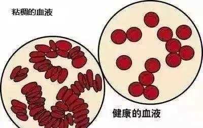 孕妇血稠对胎儿的影响(孕妇血稠对胎儿的影响) 第1张 孕妇血稠对胎儿的影响(孕妇血稠对胎儿的影响) 第1张