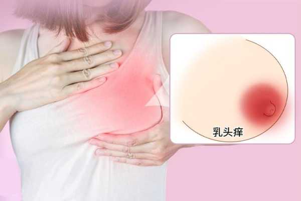 孕期乳头痒怎么缓解(怀孕期间乳头痒怎么回事) 第2张 孕期乳头痒怎么缓解(怀孕期间乳头痒怎么回事) 第2张