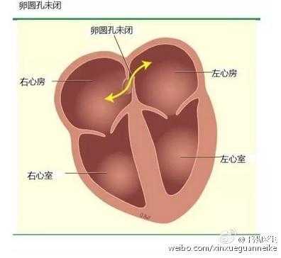 胎儿心脏卵圆孔正常值(胎儿心脏卵圆孔正常值是多少?) 第2张 胎儿心脏卵圆孔正常值(胎儿心脏卵圆孔正常值是多少?) 第2张